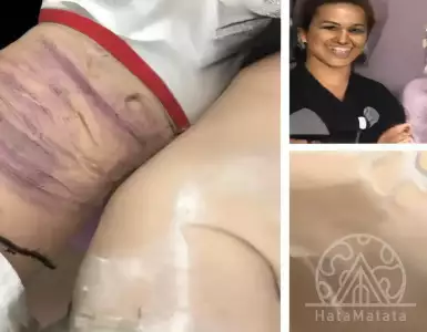 Full of clients who have undergone unsuccessful surgeries in Turkey...