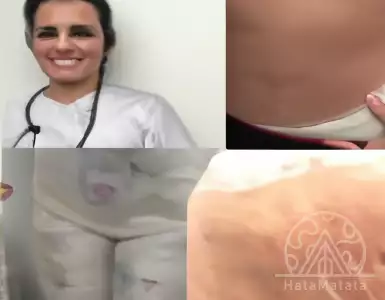 My clinic is full of victims of failed surgery in Turkey.....